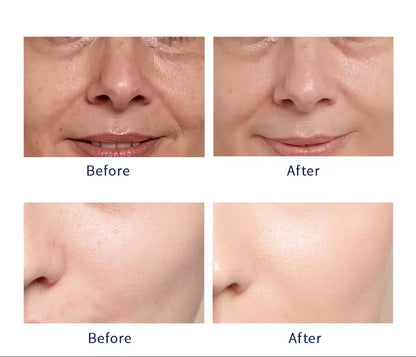 Glow Queen Black Truffle Triple Collagen Essence